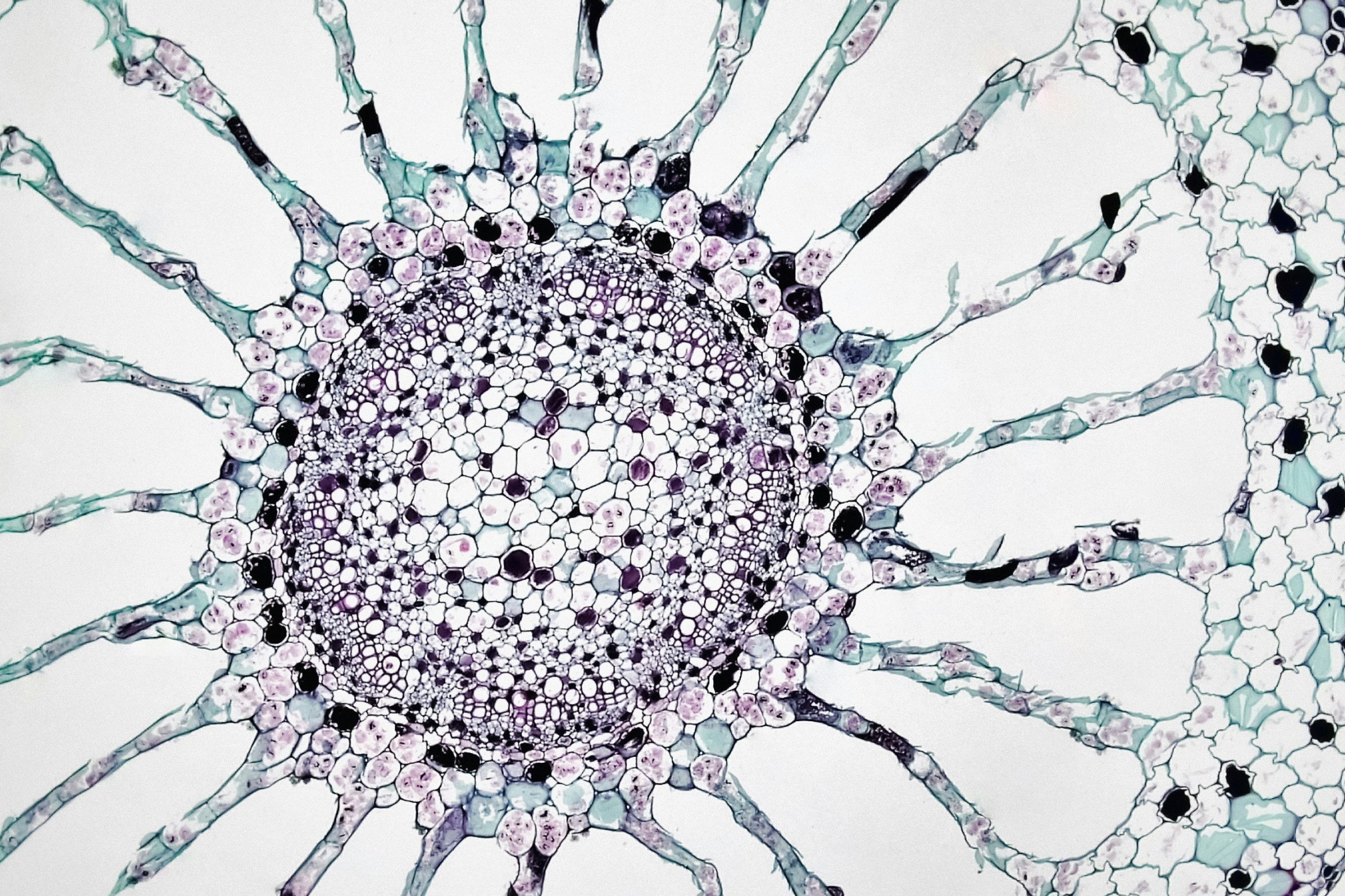 Microscopic tissue image representing reduced liver fat in patients from combined metabolic activator (CMA) therapy research.