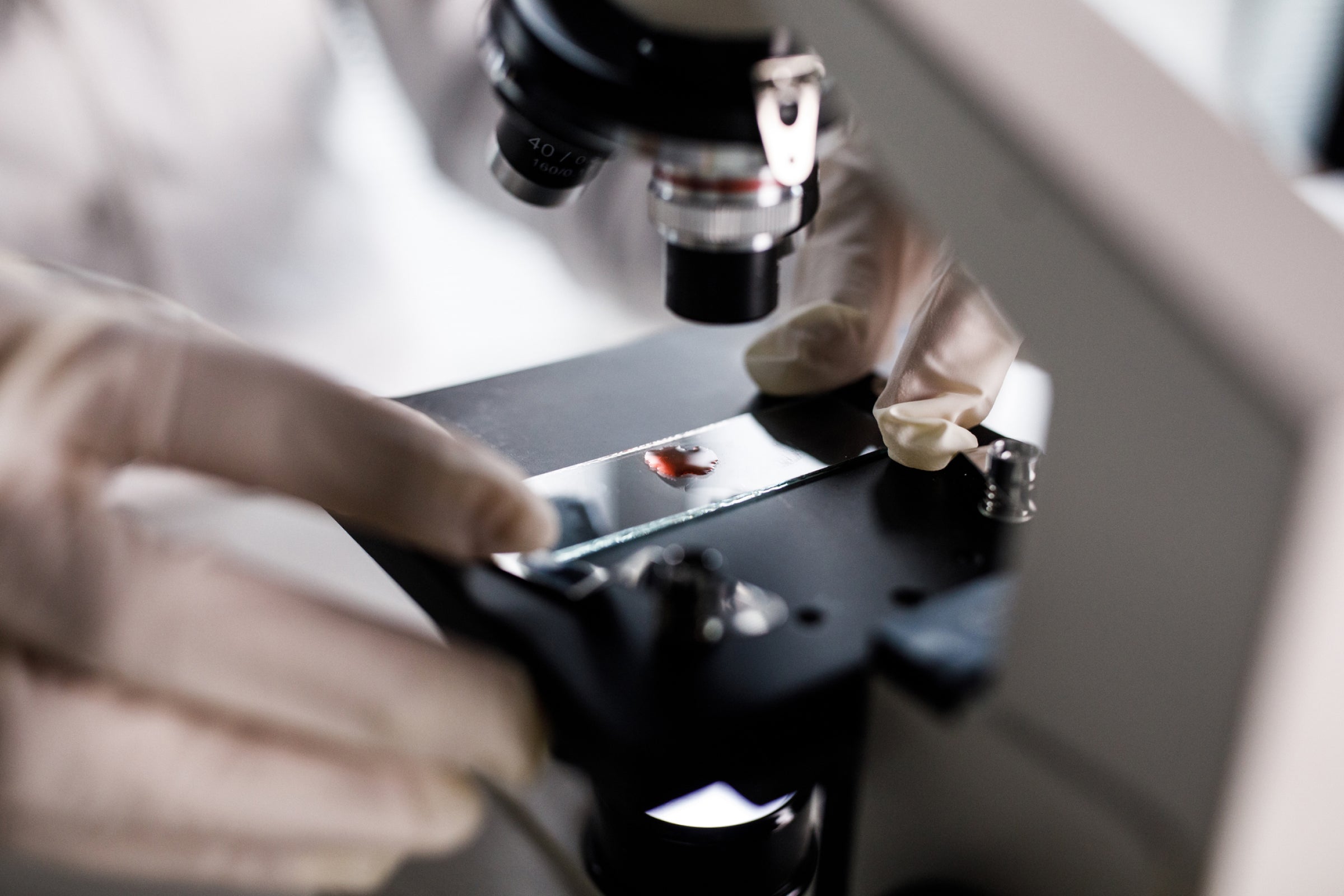 Scientist analyzing blood under a microscope, researching the impact of NAD+ on immune and blood health.