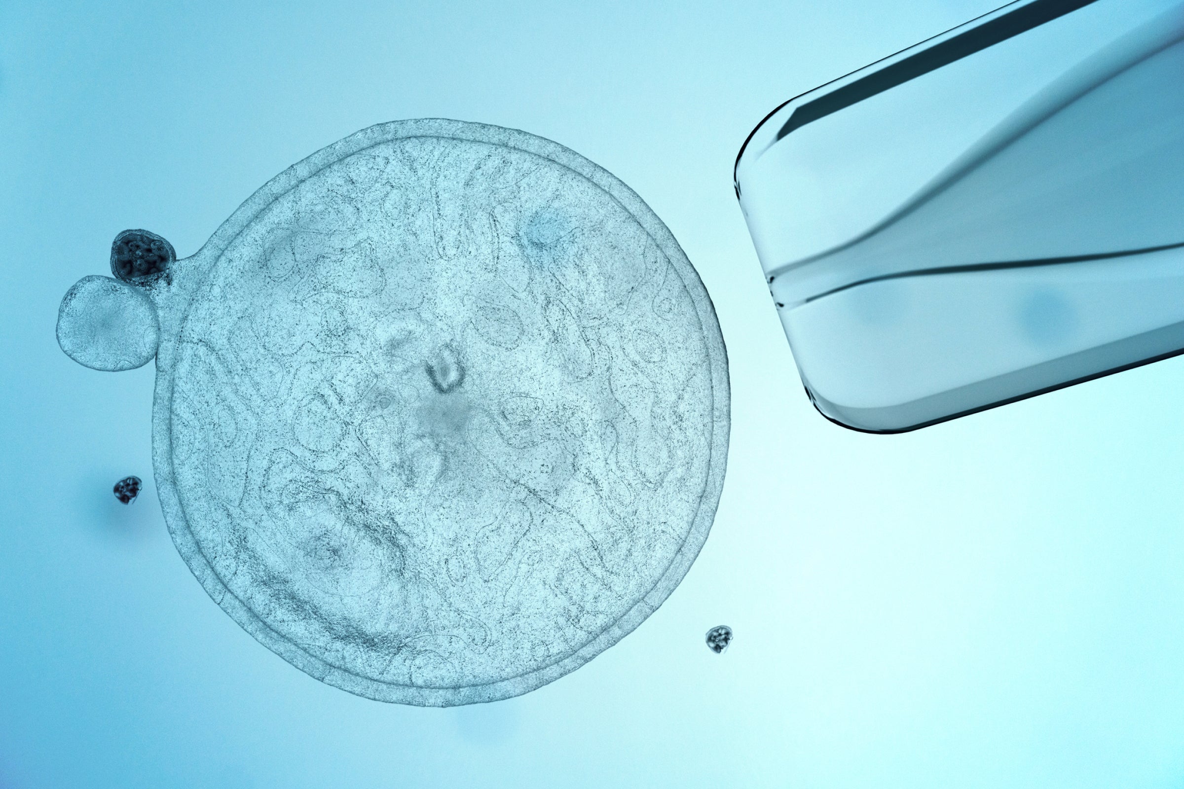 In vitro fertilization (IVF) cell with needle representing NAD+ and fertility research