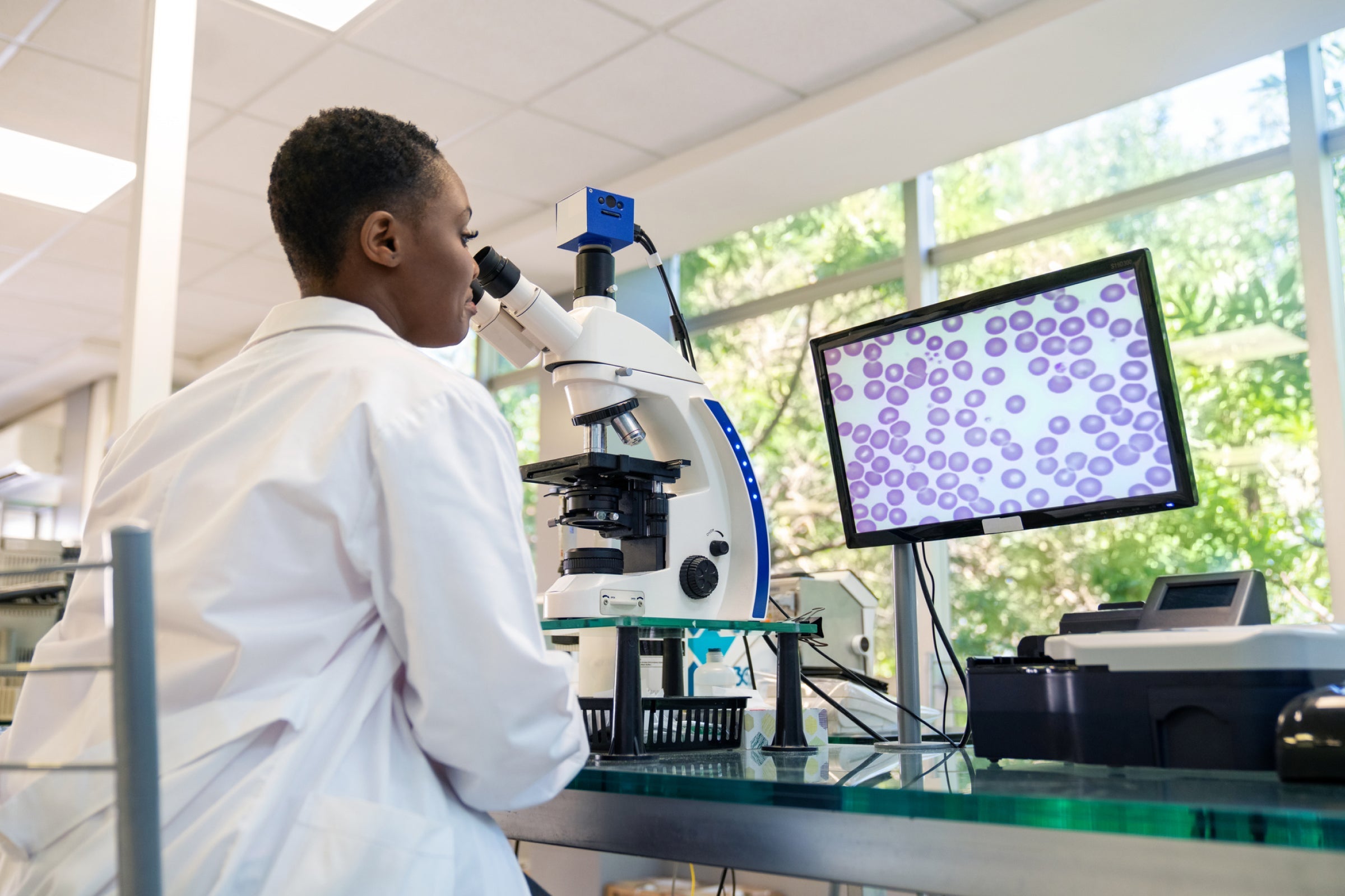 Scientist using a microscope to study immune cells, demonstrating NAD+ research in immune health.
