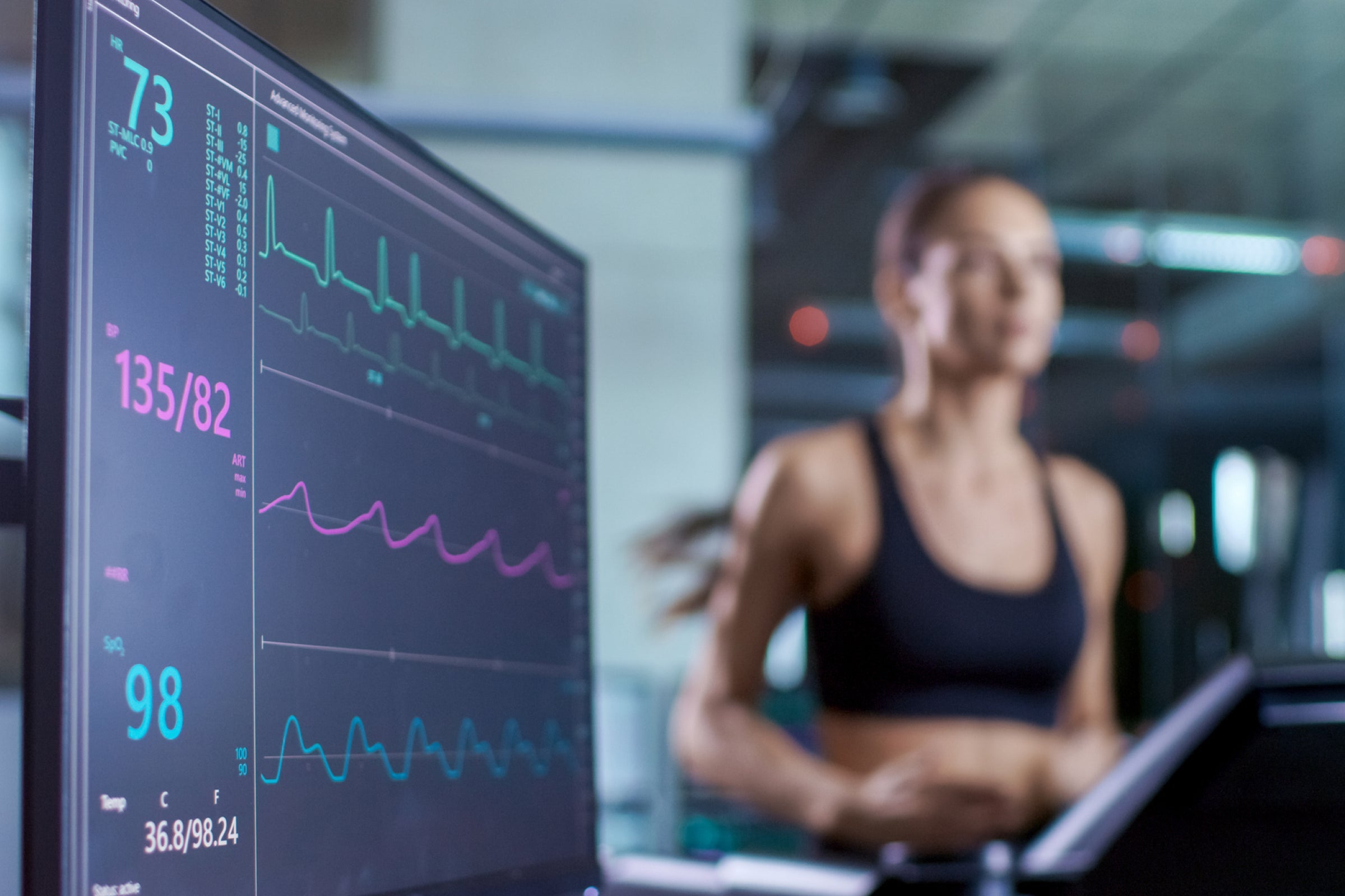 Woman running on a treadmill with EKG monitoring, highlighting NAD+ effects on metabolism and cardiovascular function.