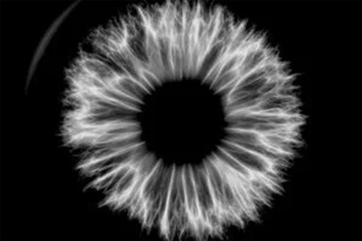 All Eyes on NAD+ as Preclinical Study Demonstrates Protection Against Light-Induced Retinal Degeneration