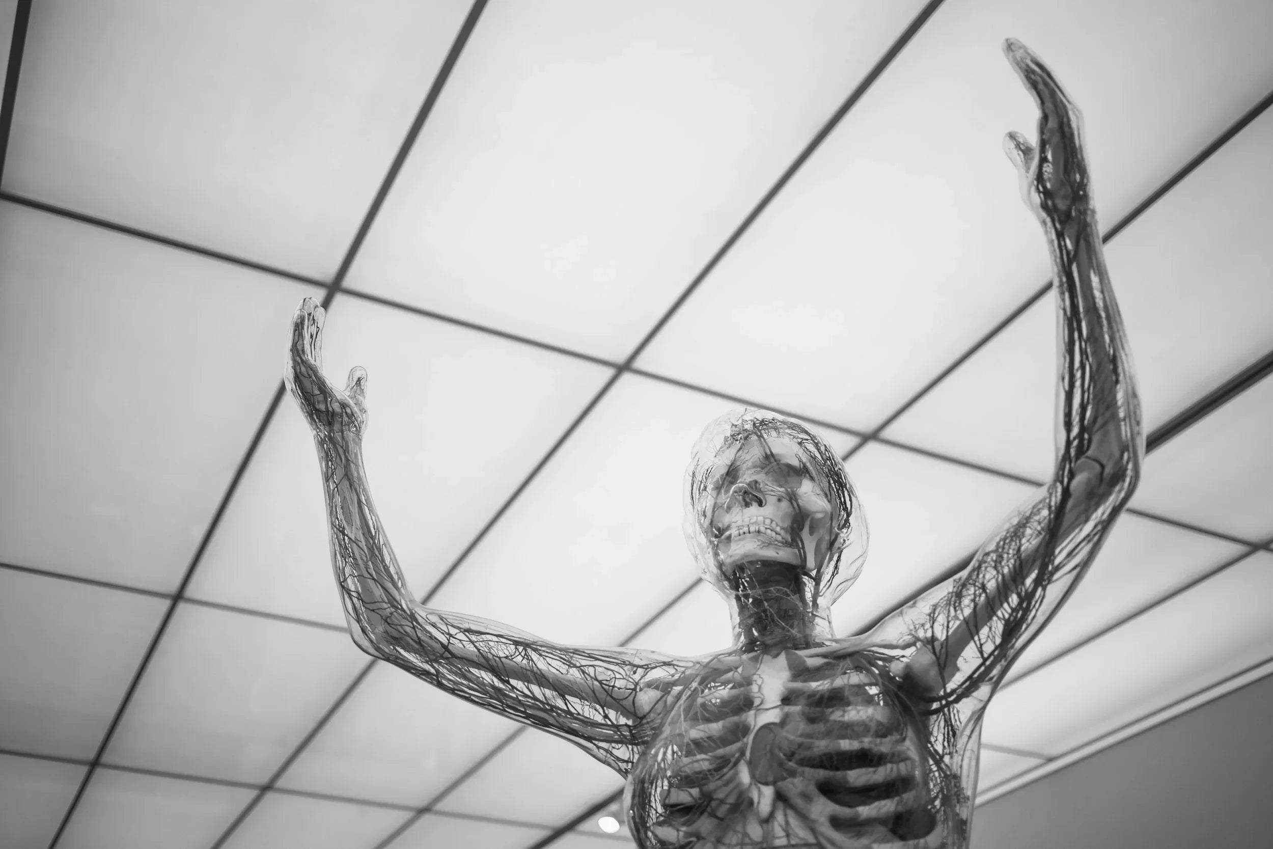 Nicotinamide Riboside Supplementation Improves Ataxia Scores and Increases Antibody Levels in Ataxia Telangiectasia Patients