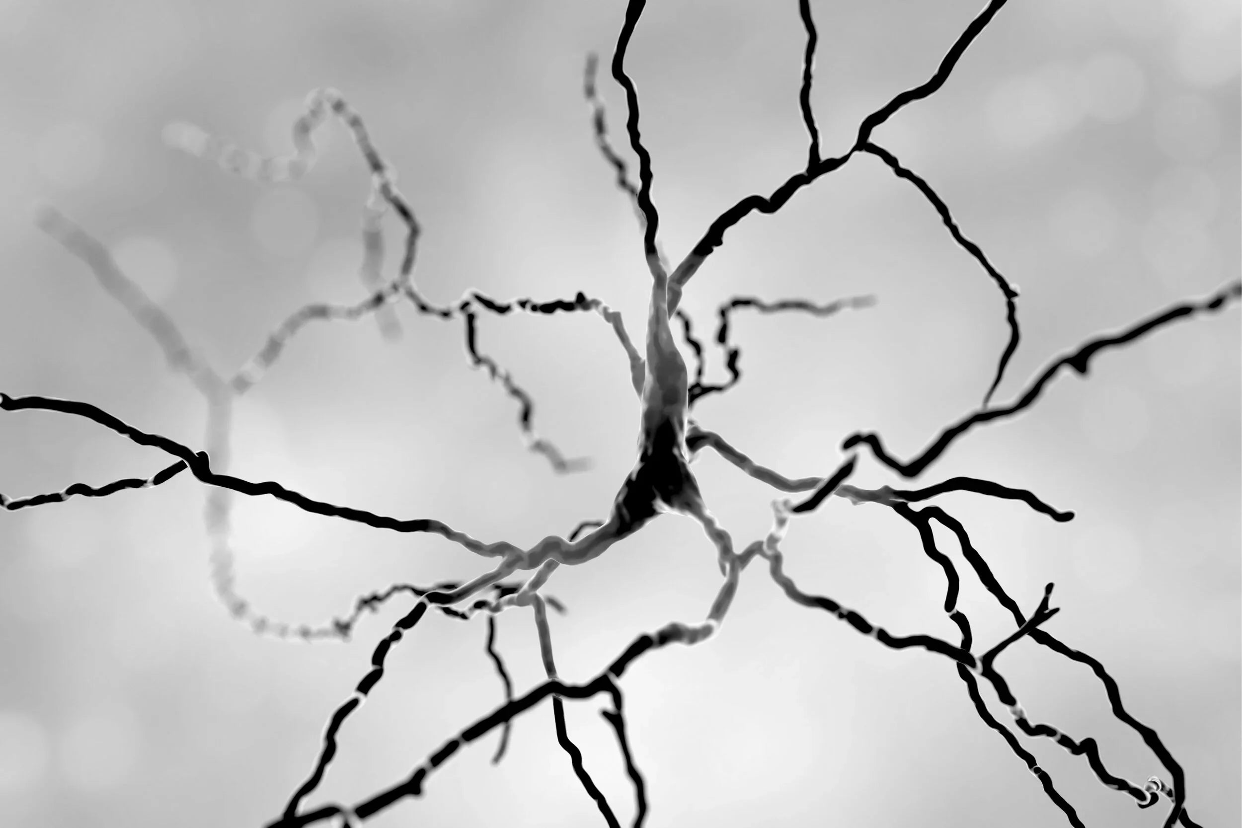 Increasing Nicotinamide Adenine Dinucleotide (NAD+) with Nicotinamide Riboside (NR) Reduced Neurodegeneration, and Increased Lifespan in Preclinical Model