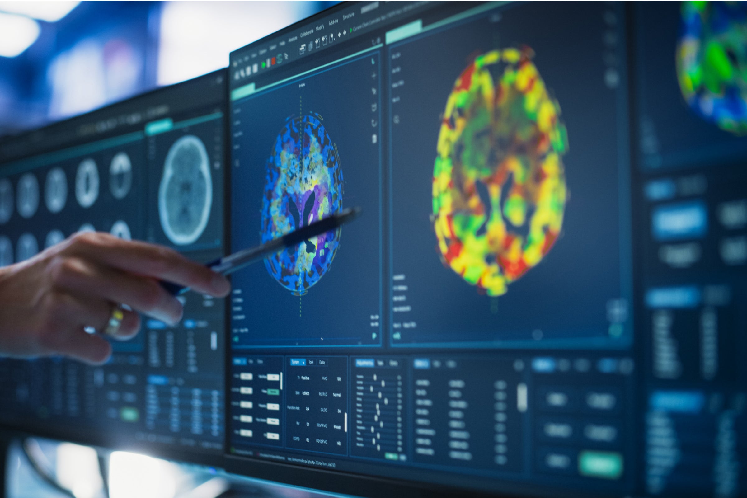 Clinician reviewing brain scans symbolizing CMA and NAD+ studies on cognitive health in Parkinson’s disease.