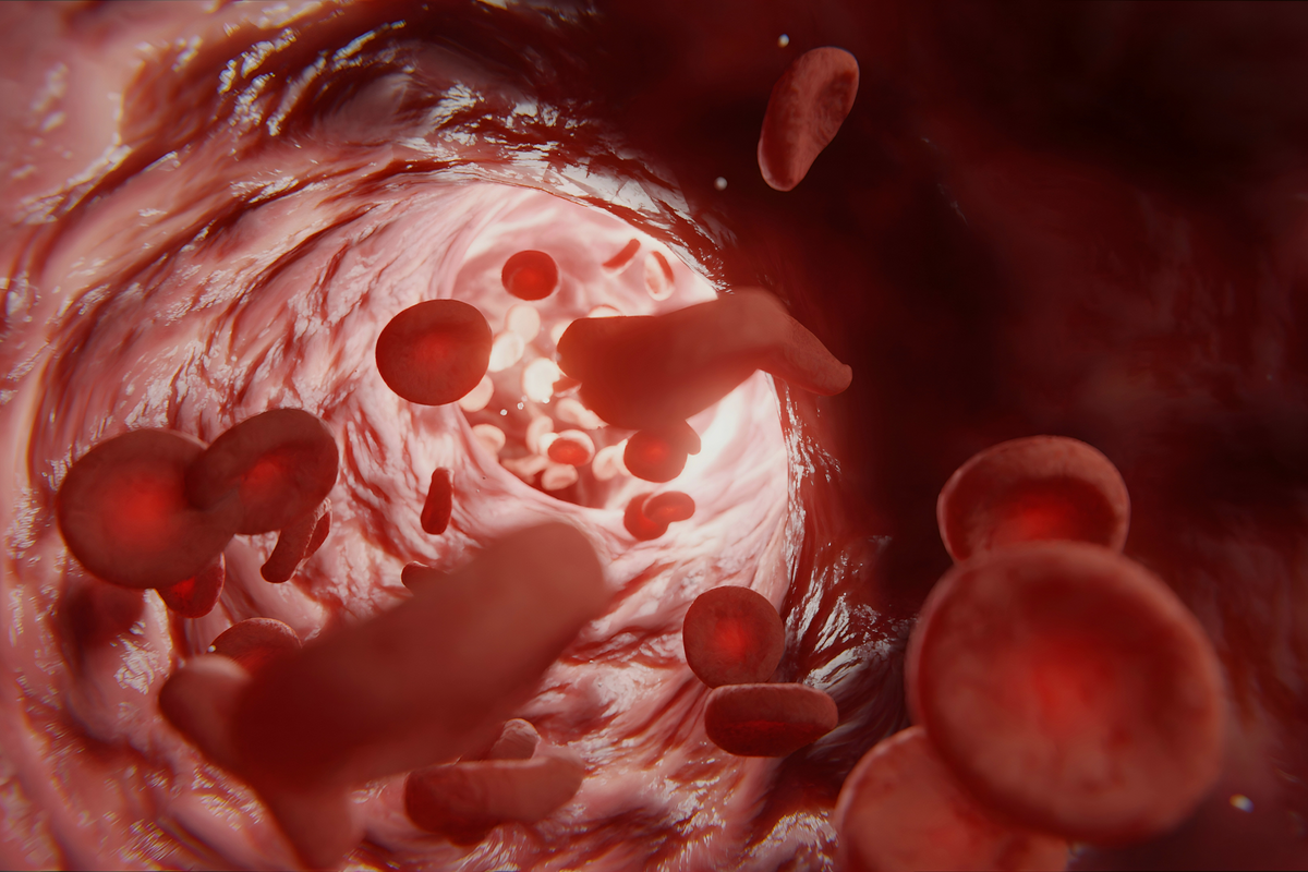 What Is Peripheral Artery Disease? | AboutNAD