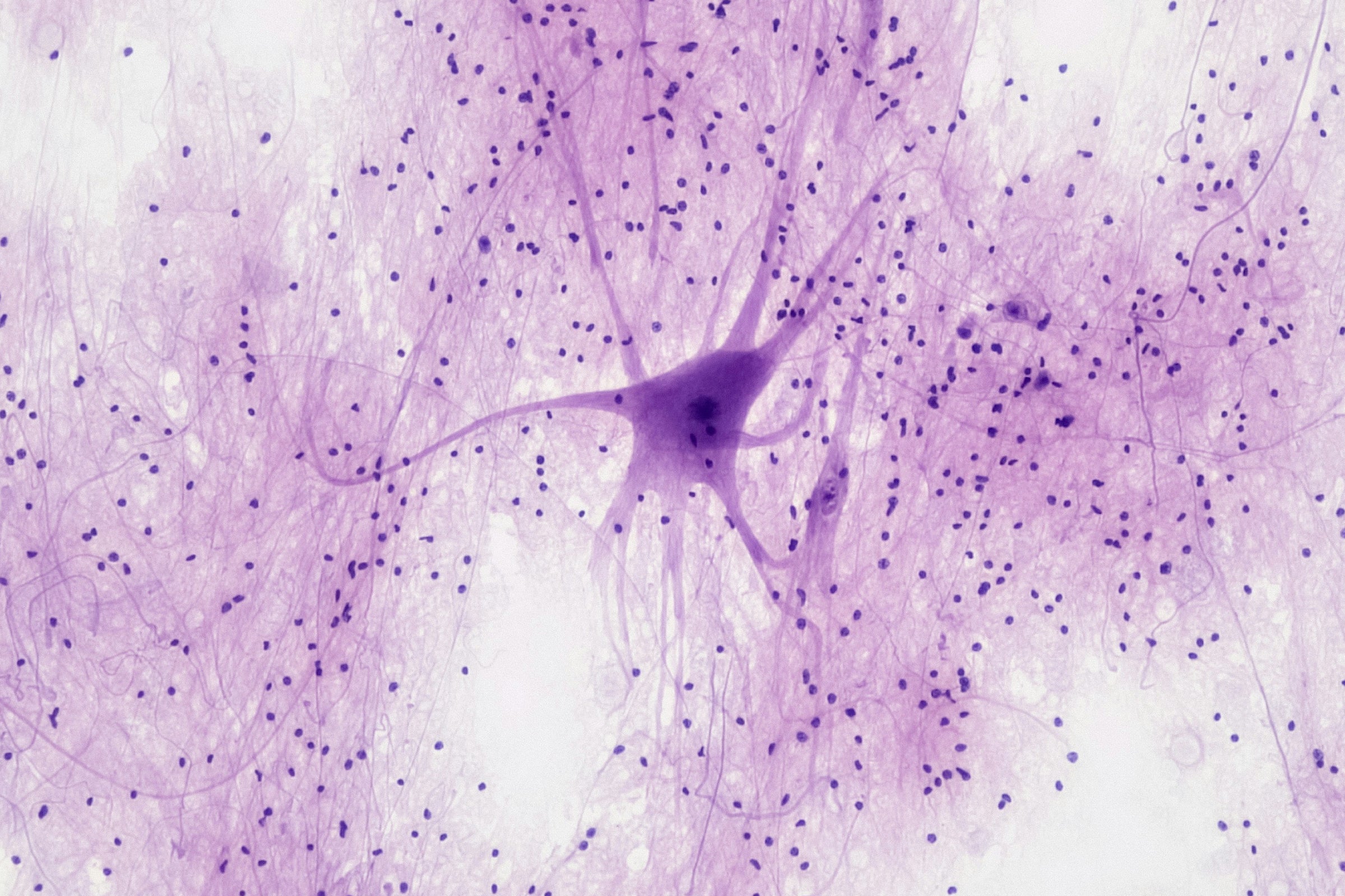 Microscopic image of neurons symbolizing nicotinamide riboside (NR) and NAD+ research on neurodegeneration.