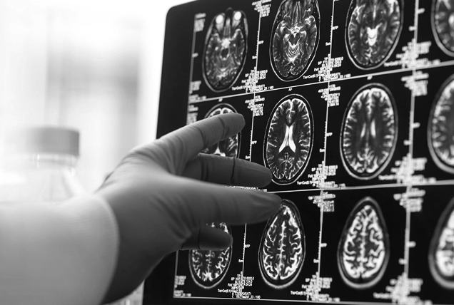 Medical researcher pointing at a brain MRI scan studying NAD+ effects on brain health and neurodegenerative disease, 2020s.